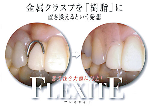 �t���L�T�C�g